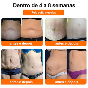 💎Technologie 5D [Propagace s omezenou dobou] Kaala™ Original Ceramic Ice Ion Fiber Repair Styler