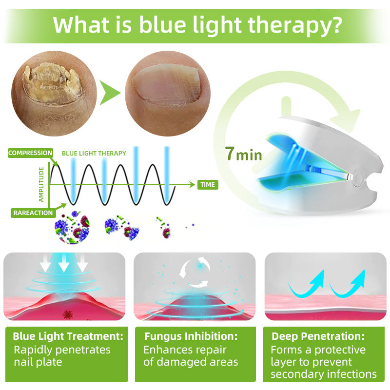 Laserové zařízení pro léčbu plísní nehtů Furzero™ Max Plus