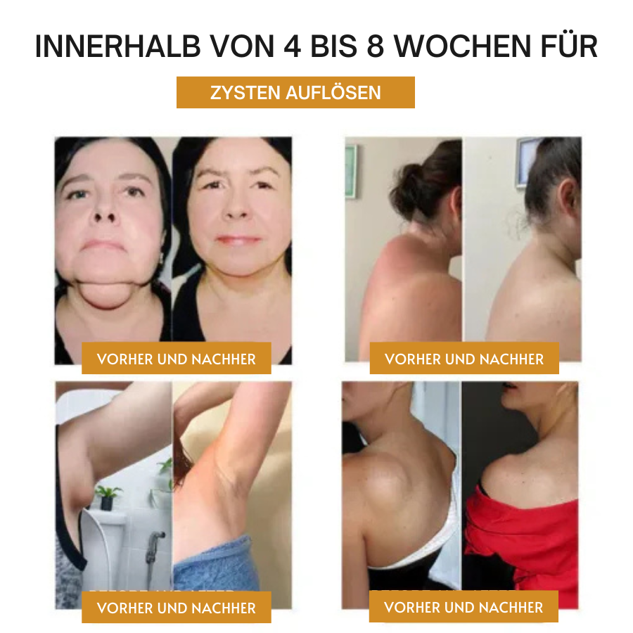 Fivfivgo™ Ultrazvukový spalovač tuků a Detox – energetická bilance
