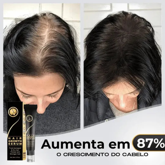 95% snížení poklesu, 20x posílení růstu | Fix Your Hair®