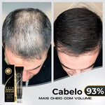 Načíst obrázek do prohlížeče Galerie, 95% snížení poklesu, 20x posílení růstu | Fix Your Hair®
