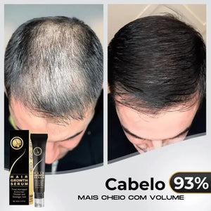 95% snížení poklesu, 20x posílení růstu | Fix Your Hair®