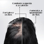 Načíst obrázek do prohlížeče Galerie, 95% snížení poklesu, 20x posílení růstu | Fix Your Hair®
