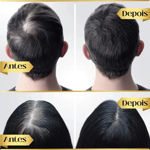 95% snížení poklesu, 20x posílení růstu | Fix Your Hair®