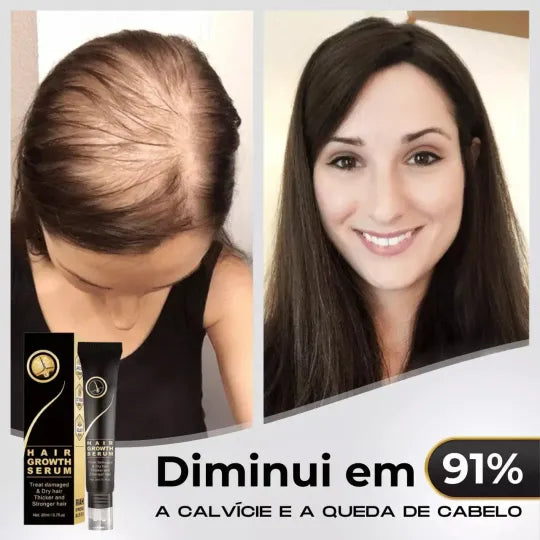 95% snížení poklesu, 20x posílení růstu | Fix Your Hair®