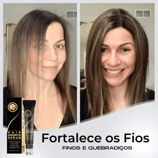 95% snížení poklesu, 20x posílení růstu | Fix Your Hair®