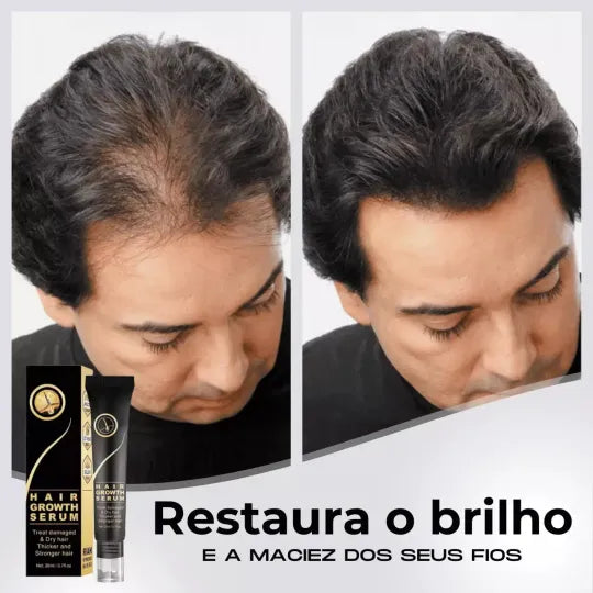 95% snížení poklesu, 20x posílení růstu | Fix Your Hair®